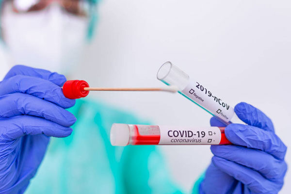 Circolare Ministero della Salute 3 Marzo 2021, n. 8284: “Vaccinazione dei soggetti che hanno avuto un’infezione da SARS-CoV-2”.