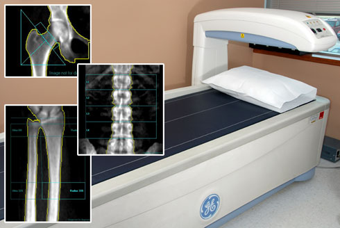 Osteoporosi la “ladra di ossa”. Prevenzione – Diagnosi e terapia. Foggia 04.11.2022. Assegnati 5 (cinque) crediti ECM per: Medici-Chirurghi (Tutte le Discipline), Odontoiatri, Farmacisti, Biologi, Psicologi, Infermieri, Ostetriche, TSRM, Fisioterapisti, Tecnici Ortopedici.